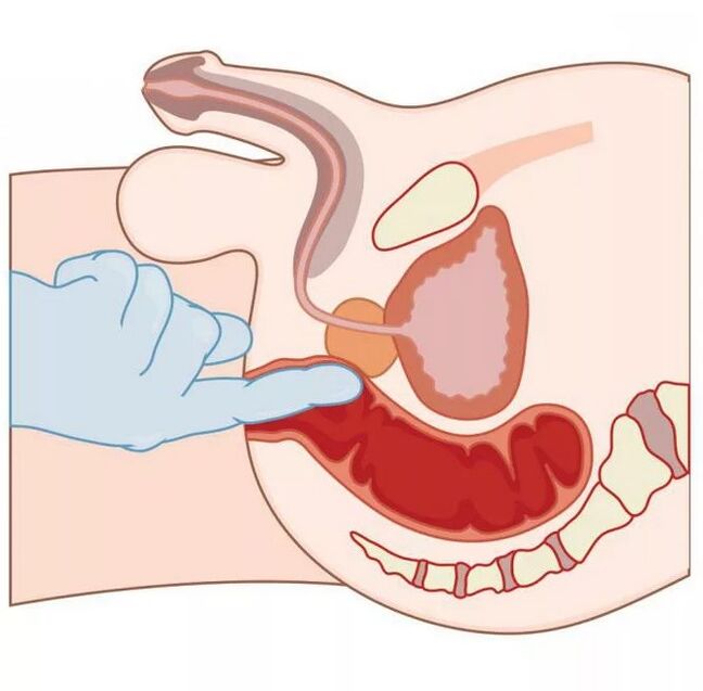 Lage des männlichen G-Punkts
